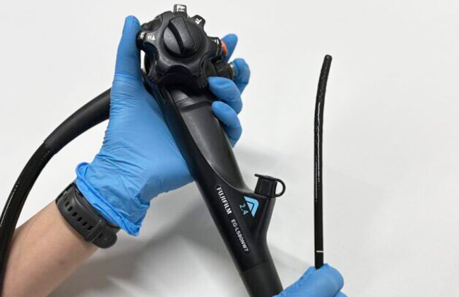 胃内視鏡（胃カメラ）